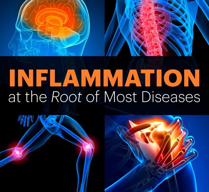inflammation